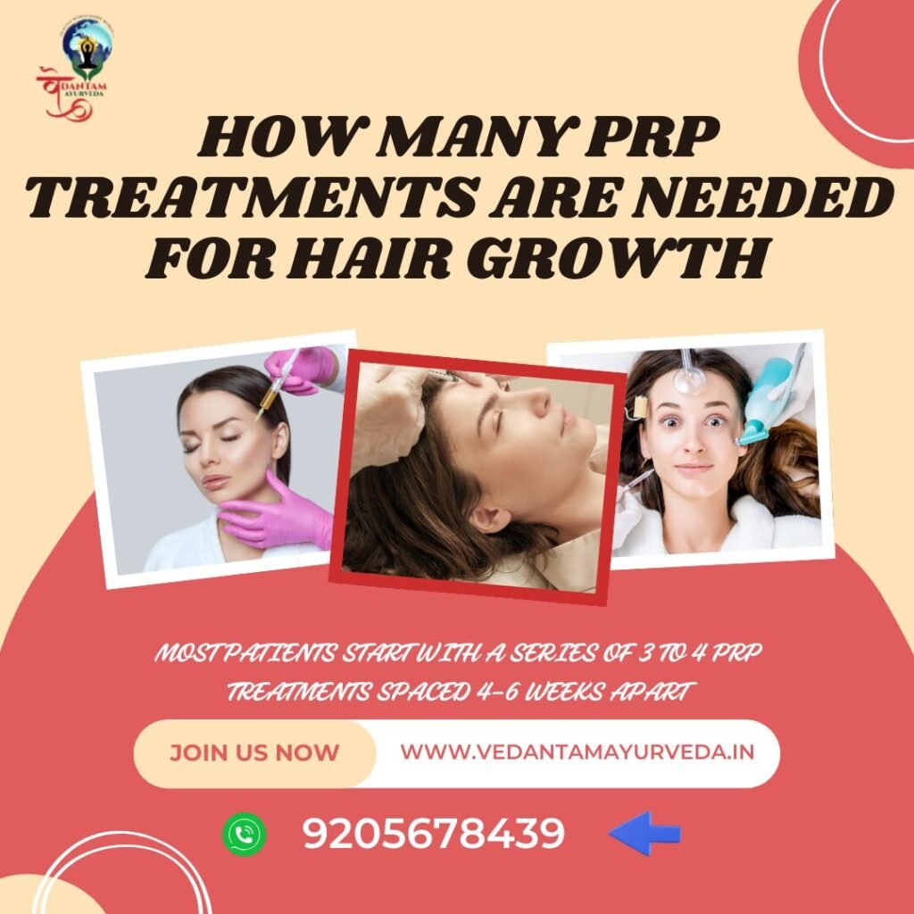 How Many PRP Treatments Are Needed for Hair Growth?