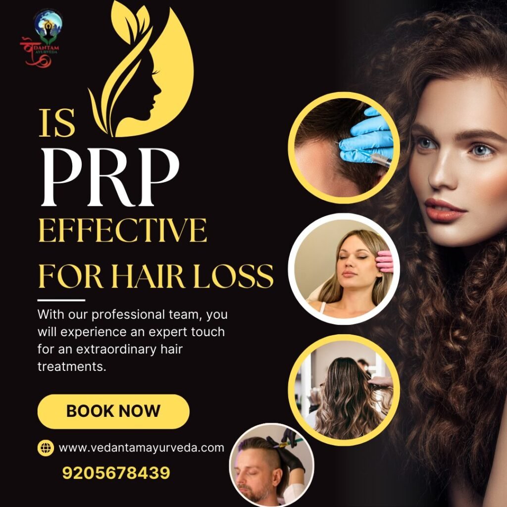 Is PRP Effective for Hair Loss?