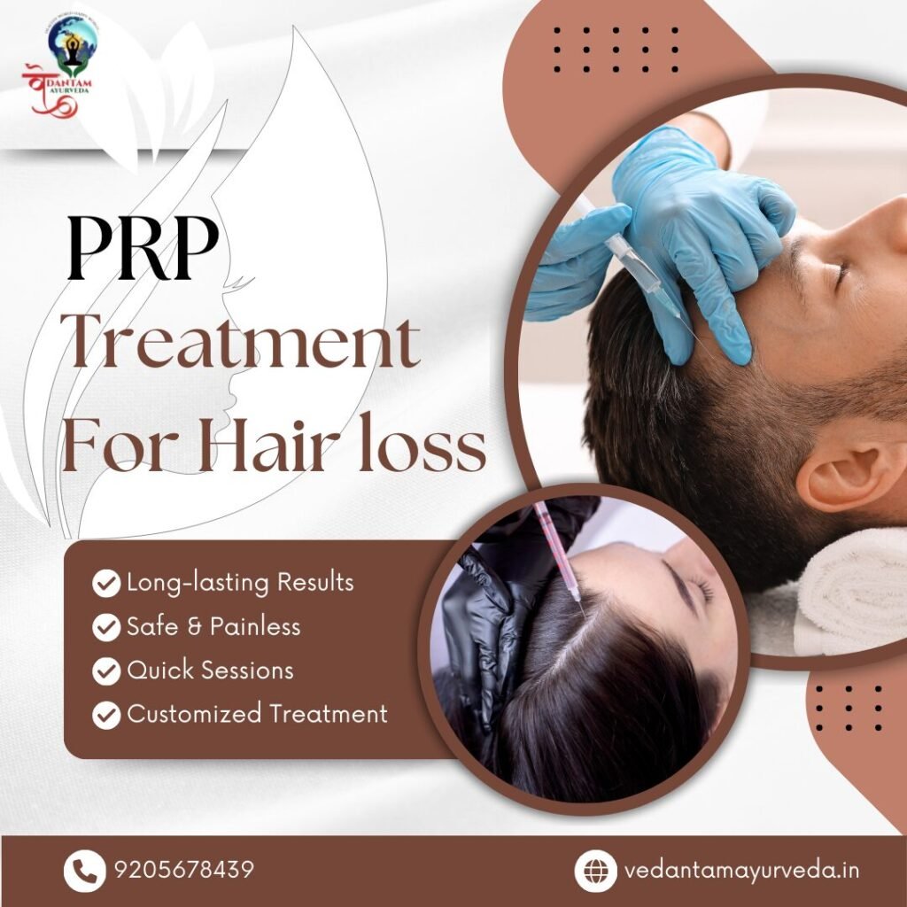 PRP Treatment for Hair Loss