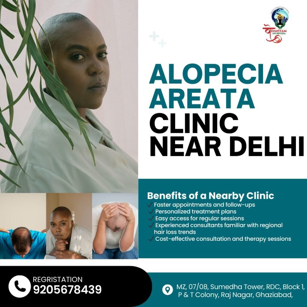 Alopecia Areata Clinic Near Delhi