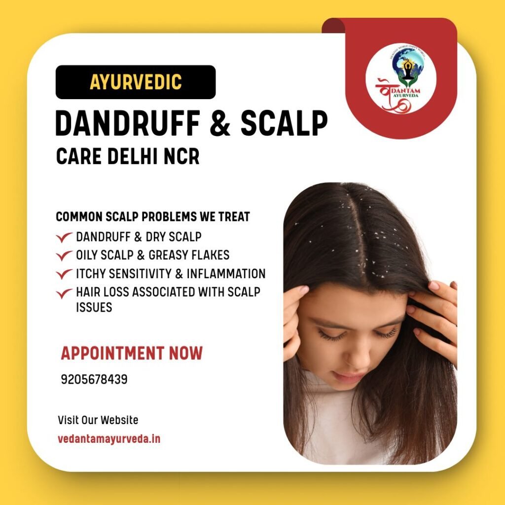 Dandruff & Scalp Care Delhi NCR